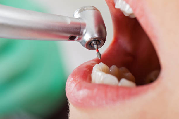  Paris, TX Emergency Dentist Pros